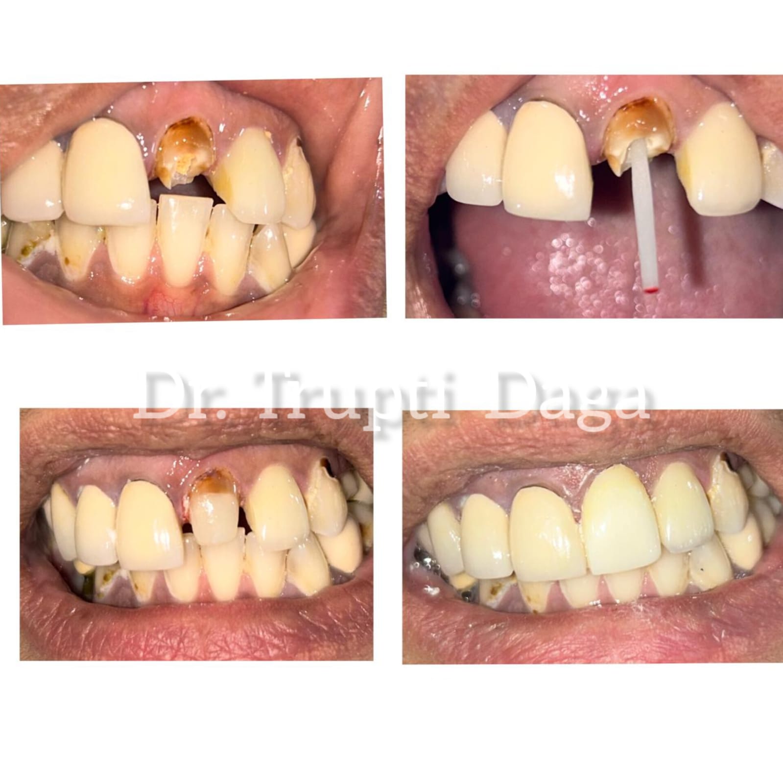 Smile transformation