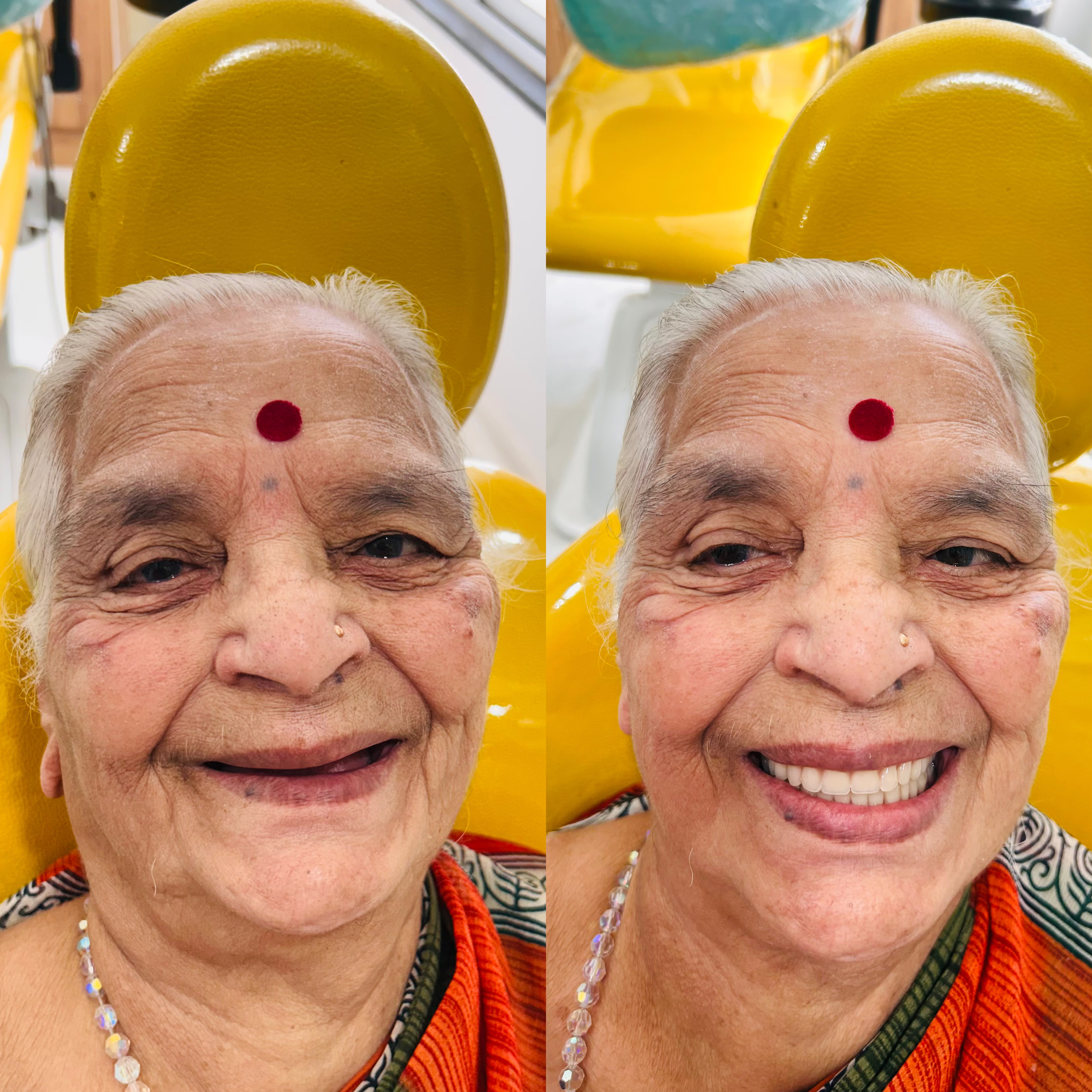 Smile transformation